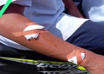 Gesekan Antar Pelajar Terjadi di Bojonggenteng, Akibatkan Tangan Salah Satu Siswa Robek