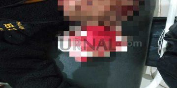 Sadis!! Wartawan Media Online di Majalengka Dibacok OTK