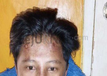 Anak Ketua RT di Banyuresmi Diduga Dikeroyok Warga Tanpa Sebab, Ketua RT 02/13 : Duh, Main Hakim Sendiri