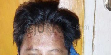 Anak Ketua RT di Banyuresmi Diduga Dikeroyok Warga Tanpa Sebab, Ketua RT 02/13 : Duh, Main Hakim Sendiri