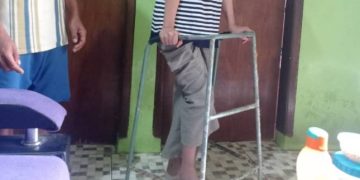 Wanita Asal Garut Ini Alami Cacat Kaki Pasca Dijadikan PMI Diduga Ilegal di Suriah