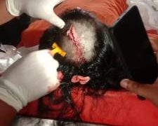 Seorang Aktifis LSM Bergerak Tertiban Batang Pohon