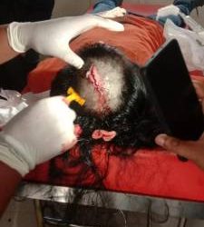 Seorang Aktifis LSM Bergerak Tertiban Batang Pohon