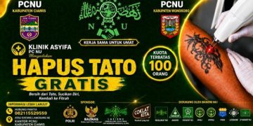 Yuk Hijrah! PCNU Ciamis Buka Program Hapus Tato Gratis untuk Laki-laki dan Perempuan