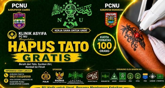 Yuk Hijrah! PCNU Ciamis Buka Program Hapus Tato Gratis untuk Laki-laki dan Perempuan